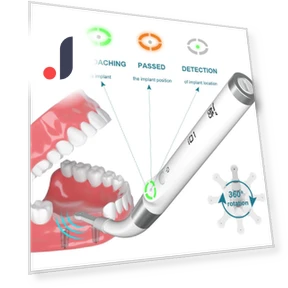 Система обнаружения зубов — Инструменты и аксессуары для имплантов, AI DENTAL