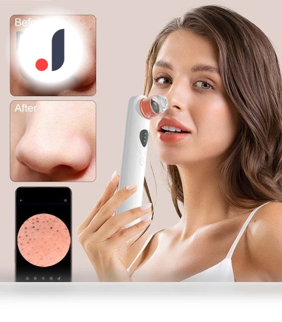 Vacuum Blackhead Remover with 1080P Camera — Blackhead & Blemish Removers, Beauty top