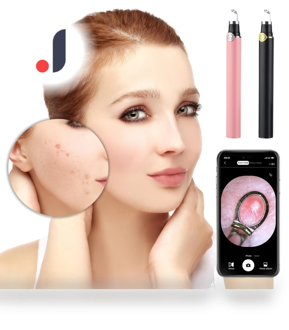 Smart Visual Blackhead Remover — Blackhead & Blemish Removers, YiGeiWoLiGiaoGiao