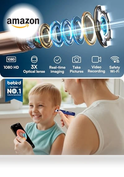 Flexible Ear Wax Removal Tool Camera — Wax Removal, BEBIRD