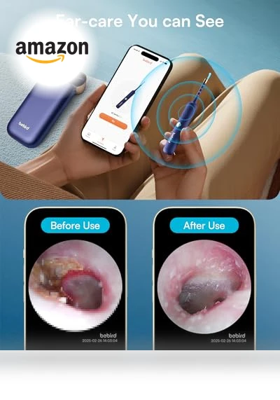 Flexible Ear Wax Removal Tool Camera — Wax Removal, BEBIRD