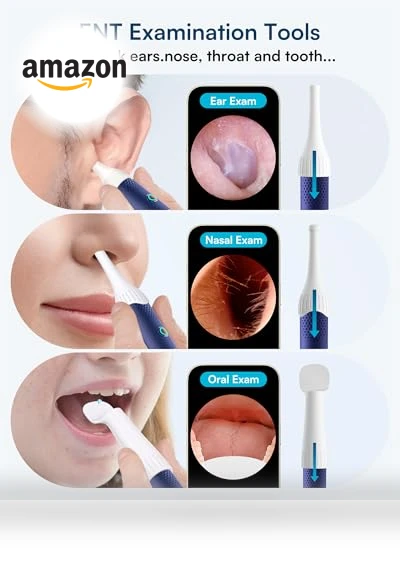 Flexible Ear Wax Removal Tool Camera — Wax Removal, BEBIRD
