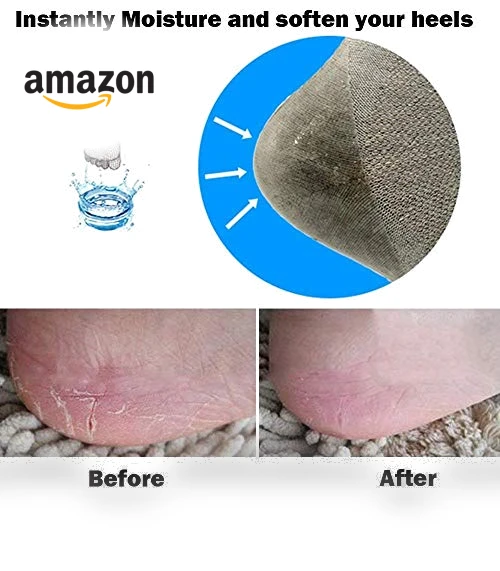 Vented Moisturizing Socks with Lotion Gel — Moisturizing Socks, Codream