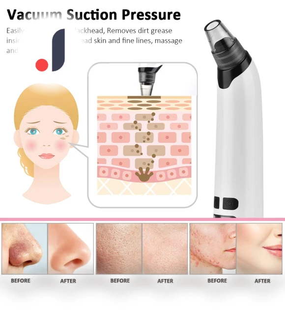 Facial Cleaner — Blackhead & Blemish Removers, Cars Auto Home