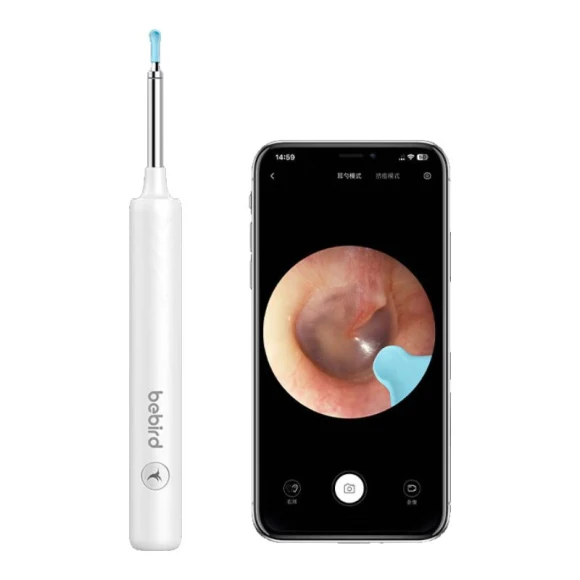 Smart Visual Ear Cleaner — Electric Ear Cleaner, BEBIRD