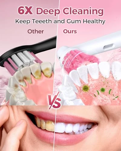 Rotating Electric Toothbrush with 8 Brush Heads — Electric Toothbrush, TEETHEORY