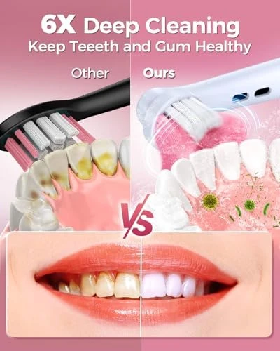 Rotating Electric Toothbrush for Adults — Electric Toothbrush, TEETHEORY