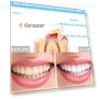 Превью Wire Control Tooth Set Accessories — Orthodontic Care Essentials