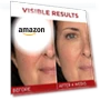Превью Revitalift Triple Power Anti-Aging Face Moisturizer — Beauty & Personal Care, L'OREAL PARIS