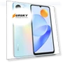 Превью Play7T Smartphone — Mobiles, Honor