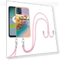 Case with Lanyard IMD Marble Pattern Electroplated TPU Back Cover — Smartwatch Protectors, Smartwatch 2025