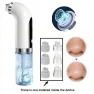Vacuum Pore Cleaner — Blackhead & Blemish Removers, Binchi