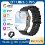 Ultra 3 Smartwatch with Amoled Display, AI Voice Assistant, and Activity Tracking — Smartwatches, Zodvboz
