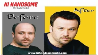 Hair Wig for Men and Women | Hair Patch | Wig Clipping | Hair Transformation