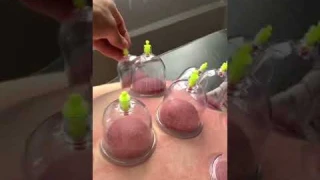 Вакуумный массаж — один из самых эффективных методов аппаратного массажа и борьбы с целлюлитом.