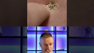 🌚СЮРПРИЗ ПОД КОЖЕЙ - чистка лица от комедонов и прыщей #чисткалица #чисткалицаотчерныхточек #прыщи