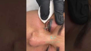 Удаление стрелочек с защитной шильдой (татуаж)