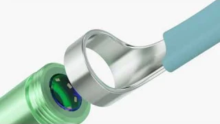 Bebird R3 Otoscope Smart Ear Cleaning Tool