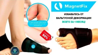 👣 Лучшее средство от косточки на ноге 😎 Magnetfox купить в аптеке 💯