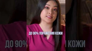 Шок 😱 Вот что будет если не лечить псориаз! #псориаз #дерматолог