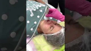 Что такое анализатор кожи?