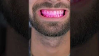 usmile toothbrush #usmileY10Pro #SmartBrushingMadeEasy #usmile #electronictoothbrush #ad