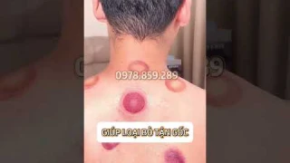 Máy Massage Giác Hơi Cạo Gió Cao Cấp