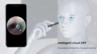 Bebird - умный прибор для чистки ушей с встроенной HD-камерой