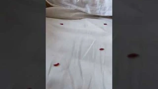 Черви ч.6🙀 Аллергия!