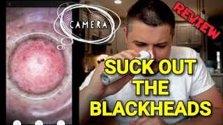 Electric Blackhead Remover w/ a Camera App REVIEW