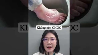 Review - Bóng nước do Bỏng - phải làm sao? #thsbsphuongquy #review #reaction #shorts