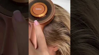 From Hair Loss to Hair Growth Breo Scalp Massager Results in JUST 30 Days!