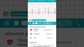 Смарт часы с суточной записью АД и интервалов ЭКГ
