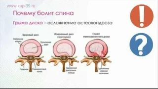 Как лечить грыжу позвоночника аппаратом DЭHAC-BEPTEБPA