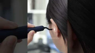 2025 Bebird EarSight Plus I35R-D39R Ear Cleaner Smart HD Visual Ear Wax Removal Stick Endoscope Mini