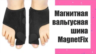 🤧 Шишки на пальцах ног сверху