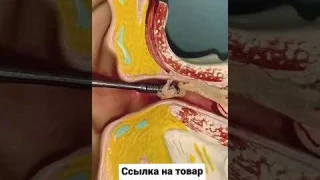 Набор для чистки ушей😍😍😍 #shorts