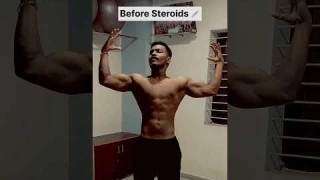 Before and after steroids 💉 #steroid #gym #bodybuilding #bodybuilder #trending #shorts #fitness