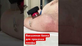 Вакуумная банка AchedAway Cupper
