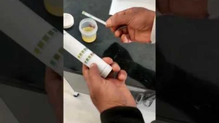 Urine test for sugar & albumin percentage #viral #youtubeshort #trending #mbbs