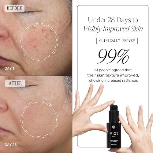 Perfection Moisturizer, Exotropin, LLC