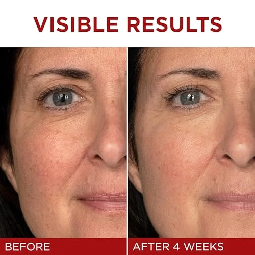 Revitalift Triple Power Anti-Aging Face Moisturizer, L'OREAL PARIS