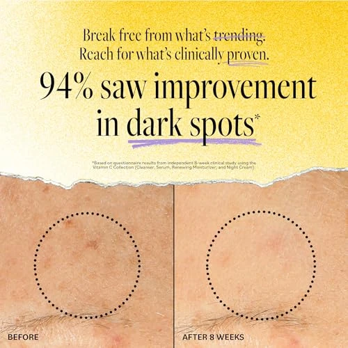 Vitamin C Renewing Moisturizer, Derma E