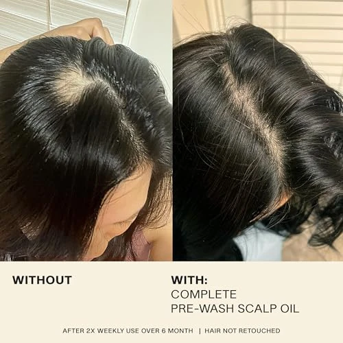 Complete Hair and Scalp Oil With Rosemary, JVN