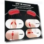 Mini Smart Massager for Neck and Shoulders — Back Relief Solutions, Wrigleys