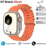 Smart Watch with AI, Amoled Display, and App Store — Smartwatches, DT