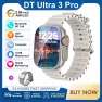 Smart Watch with AI Assistant, AMOLED Display, and Bluetooth Calling — Smart Watch, DT