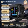 Smart Watch with ECG+PPG and AI Health Diagnostics, PRISMA