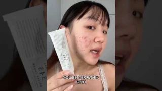 Is 345 cream worth it? 🥴YesStyle code: GRACE888 to get $$ off 🙂‍↕️#skincare #kbeauty #acne