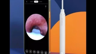 Умный набор для чистки ушей Sunuo FIND X Visual multifunctional ear picking stick